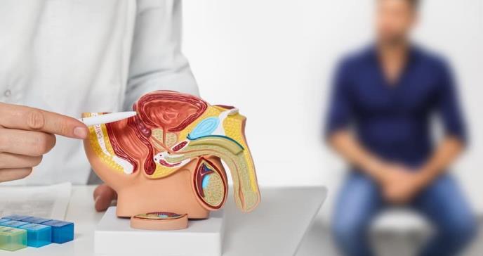 Uno de cada siete hombres tendrá cáncer de próstata en Puerto Rico