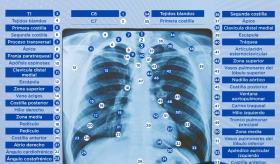 Radiografía anatomía del tórax - Infografía