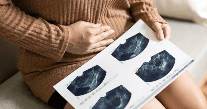 Impacto del tratamiento para el cáncer cervicouterino en la fertilidad femenina