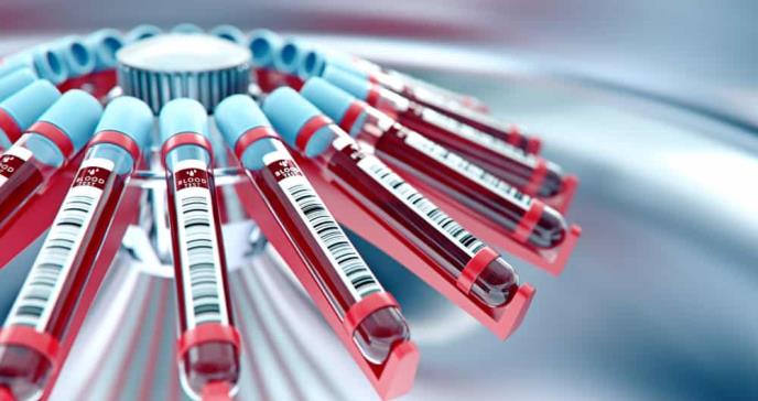 Prueba detecta 14 tipos de cáncer en estadios tempranos mediante un análisis de sangre
