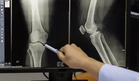 Asocian inyecciones de corticosteroides con significativa progresión de osteoartritis en la rodilla