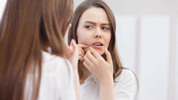 ¿Acné los días antes de la regla? Conoce algunas razones