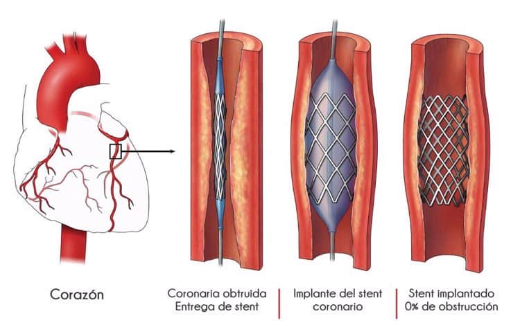 imagen-cuerpo