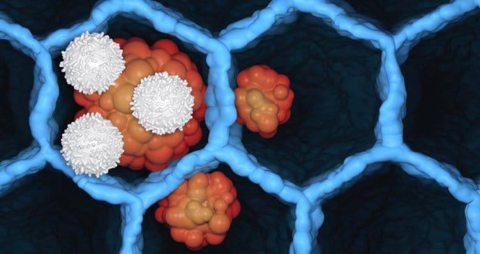 Cáncer recurrente: ¿Es posible que se vuelva a desarrollar la enfermedad ya superada?