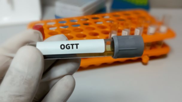 Todo lo que debe saber de la prueba de glucosa Todo lo que debe saber de la prueba de glucosa