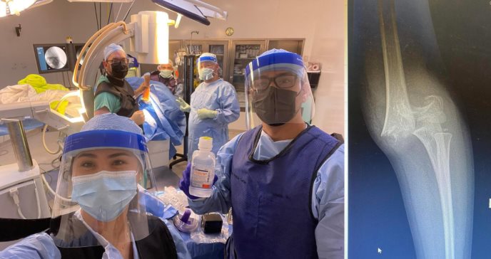 Sirviendo con calidad y empatía: operan el codo de niño de 6 años en año nuevo en Puerto Rico