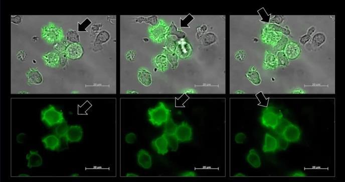 Mediante un beso células cancerígenas se abren camino frente a las defensas del cuerpo