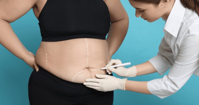 Cirugía bariátrica revertiría síntomas de hipertensión y diabetes