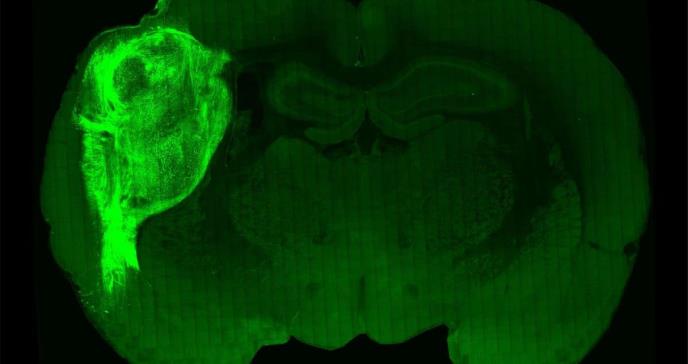 Insertan neuronas humanas en ratas y cambian su comportamiento