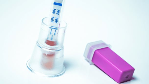 Test rápidos para identificar el VIH son claves para aumentar las tasas de diagnóstico Test rápidos para identificar el VIH son claves para aumentar las tasas de diagnóstico