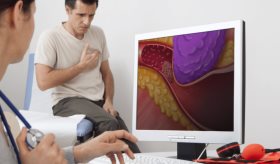 ¿Qué son los tumores cardíacos?