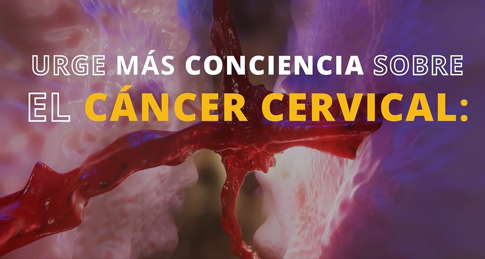 #EspecialMSP | Las Voces de Rhaiza: urge más conciencia sobre el cáncer cervical