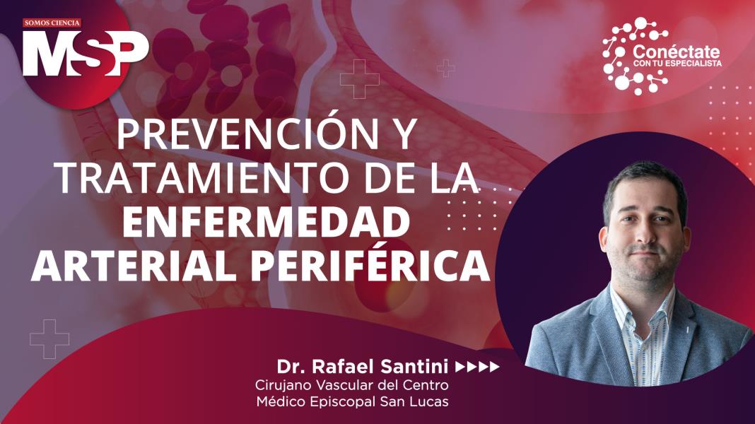 #ProgramaEspecial | Prevención de la enfermedad arterial periférica