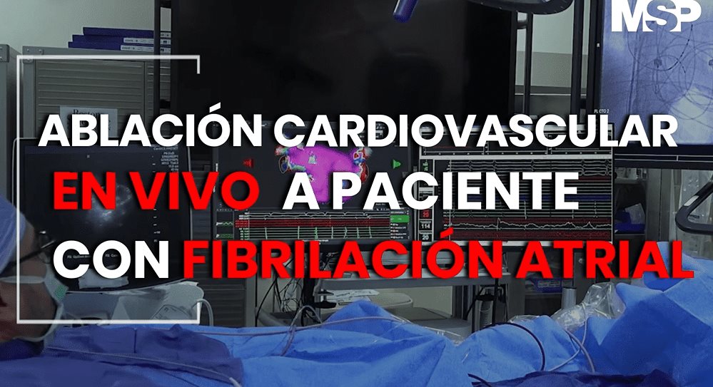 Ablación Cardiovascular en vivo a paciente con Fibrilación atrial - #ExclusivoMSP