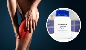 Calambres musculares e hipopotasemia, la insuficiencia de potasio que puede ser mortal