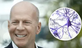 Demencia Frontotemporal: el trastorno neuronal que afecta al actor Bruce Willis