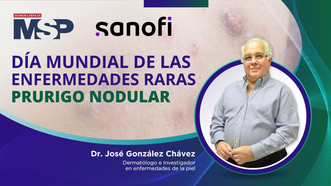 #ProgramaEspecial | Prurigo nodular en el Día Mundial de las Enfermedades Raras
