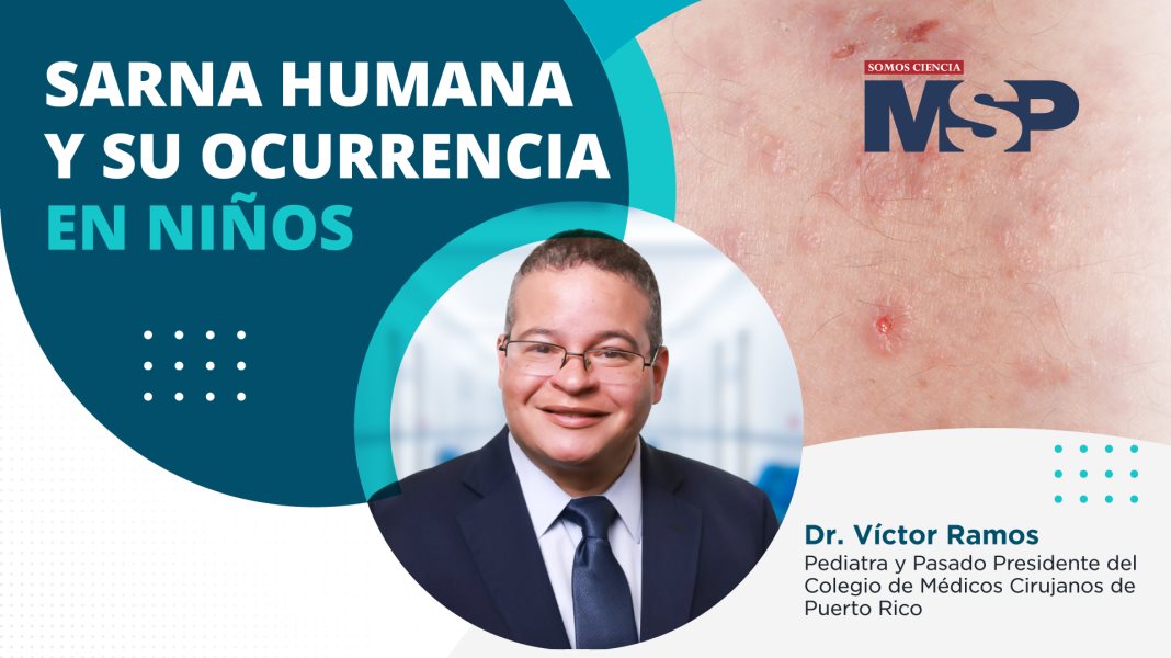 #MSPSaludPública | Sarna humana y su ocurrencia en niños