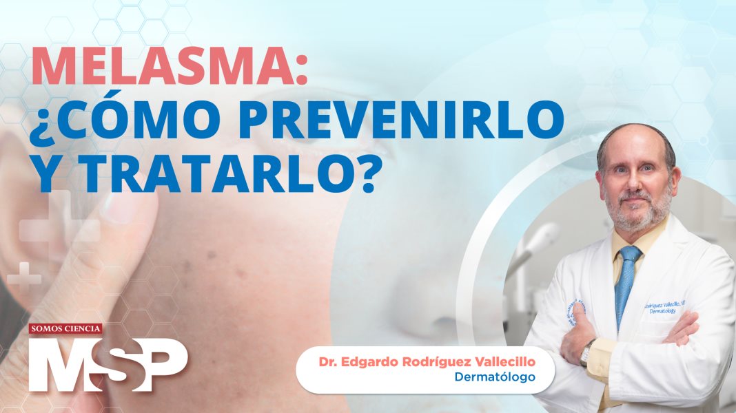 Melasma: ¿cómo prevenirlo y tratarlo?