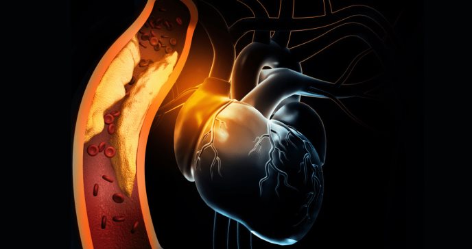 Edulcorante artificial aumentaría el riesgo de ataque cardíaco y derrame cerebral