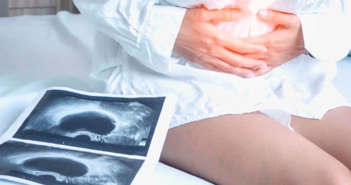 Tratamientos moleculares para la endometriosis