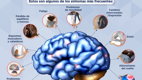 Comprendiendo los síntomas de la Esclerosis Múltiple - Infografía