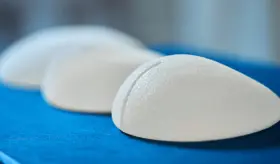 Así funciona el Síndrome de ASIA, la creciente enfermedad inducida por implantes mamarios o vacunas