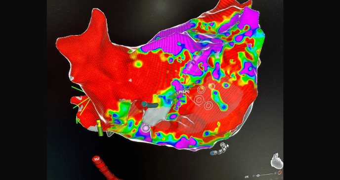 Hospital Damas, componente principal en la innovación de la electrofisiología