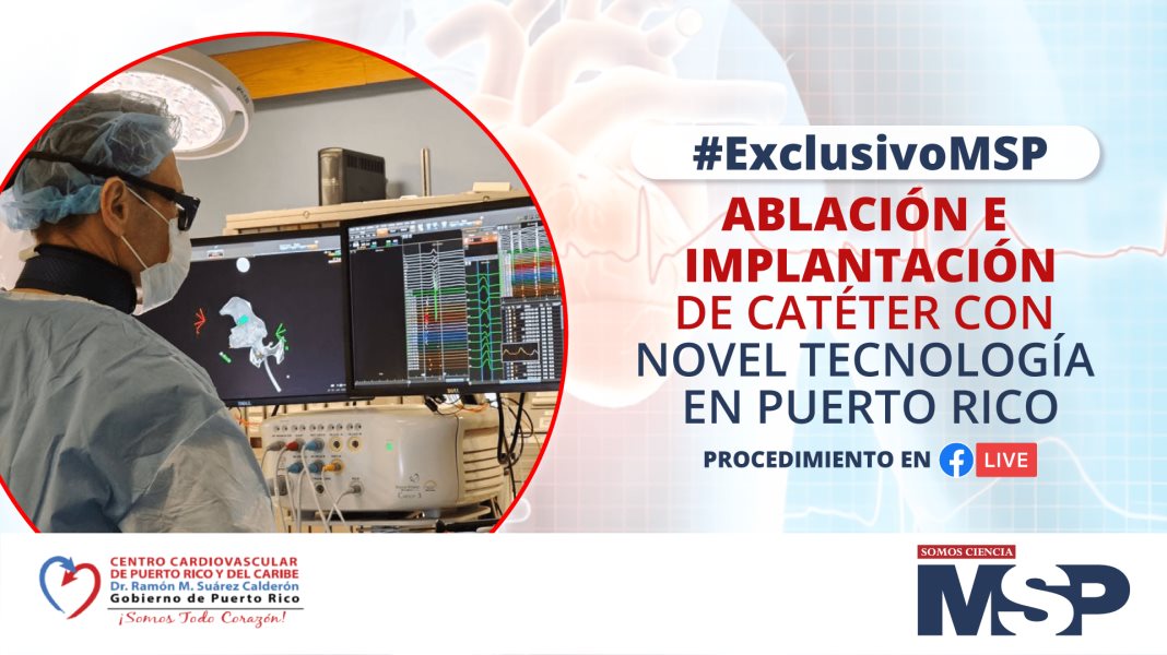 Ablación e implantación con novel tecnología en Puerto Rico - #ExclusivoMSP