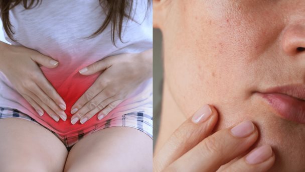 Ácido tranexámico: una poderosa sustancia que trata el sangrado abundante y las manchas de la piel Ácido tranexámico: una poderosa sustancia que trata el sangrado abundante y las manchas de la piel