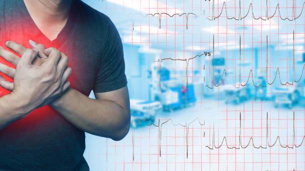Julián Figueroa y la muerte cardíaca súbita: ¿Qué es fibrilación ventricular e infarto de miocardio? Julián Figueroa y la muerte cardíaca súbita: ¿Qué es fibrilación ventricular e infarto de miocardio?