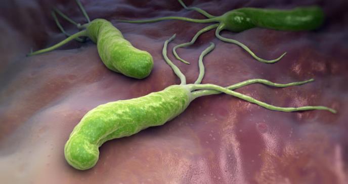 Identifican una mucosa que oculta el cáncer de estómago