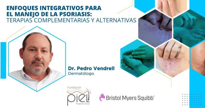 ¿Son los medicamentos biológicos la mejor opción para tratar la psoriasis?