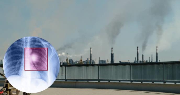 Identifican partículas contaminantes que provocan cáncer pulmonar: estudio