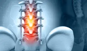 Realidad virtual como herramienta de apoyo en cirugía de columna lumbar