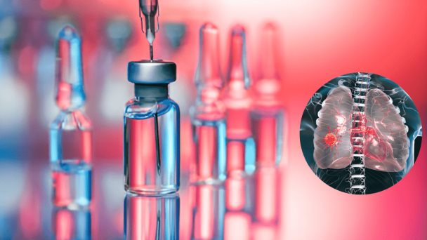 Vacuna contra el cáncer de pulmón: España será el primer país en aplicarla