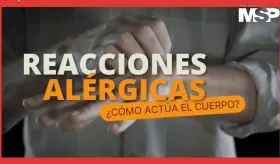 Reacciones alérgicas | ¿Cómo actúa el cuerpo?