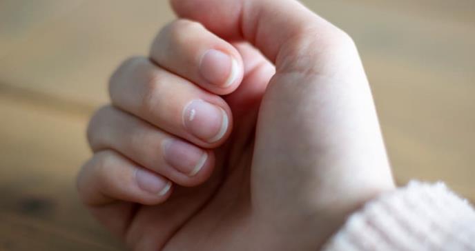 Cambios en algunos tejidos externos en pacientes que padecen de cáncer