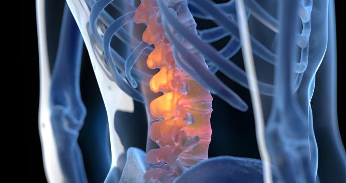 Estudio evidencia que la Terapia Funcional Cognitiva (CFT) reduce el dolor lumbar crónico en pacientes