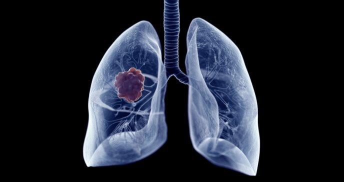 Pruebas para detectar el Cáncer de pulmón