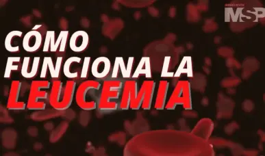 ¿Cómo funciona la leucemia? - #ExclusivoMSP