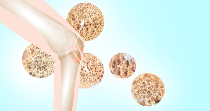 Mieloma múltiple: Nueva herramienta identifica a los pacientes con mejor pronóstico