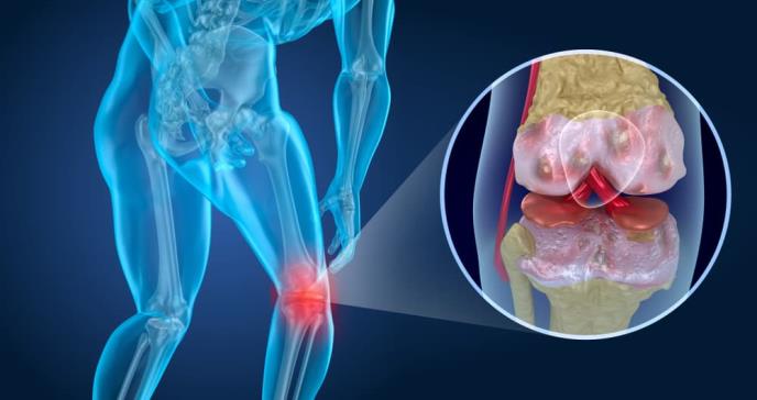 El impacto de la bipedestación en las articulaciones de rodilla y pelvis a lo largo de la evolución
