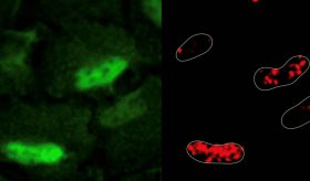 Enzimas antioxidantes protegen el ADN y ofrecen promesas para el cáncer, según estudio