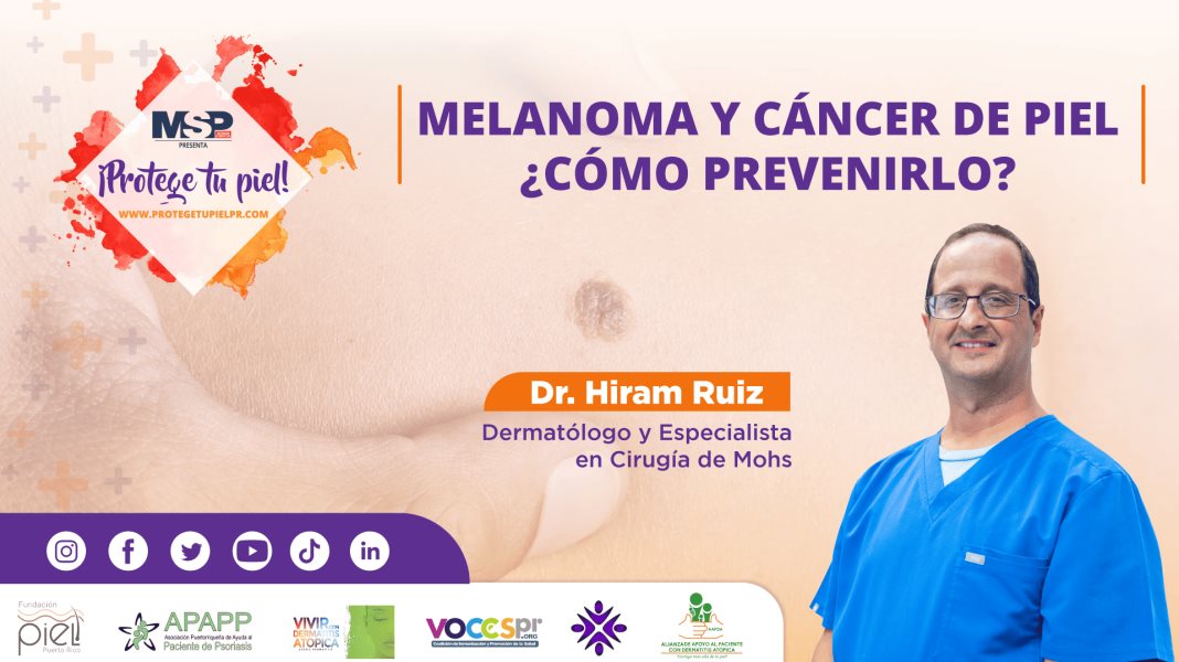 #ProtegeTuPiel | Melanoma y cáncer de piel: ¿Cómo prevenirlo?