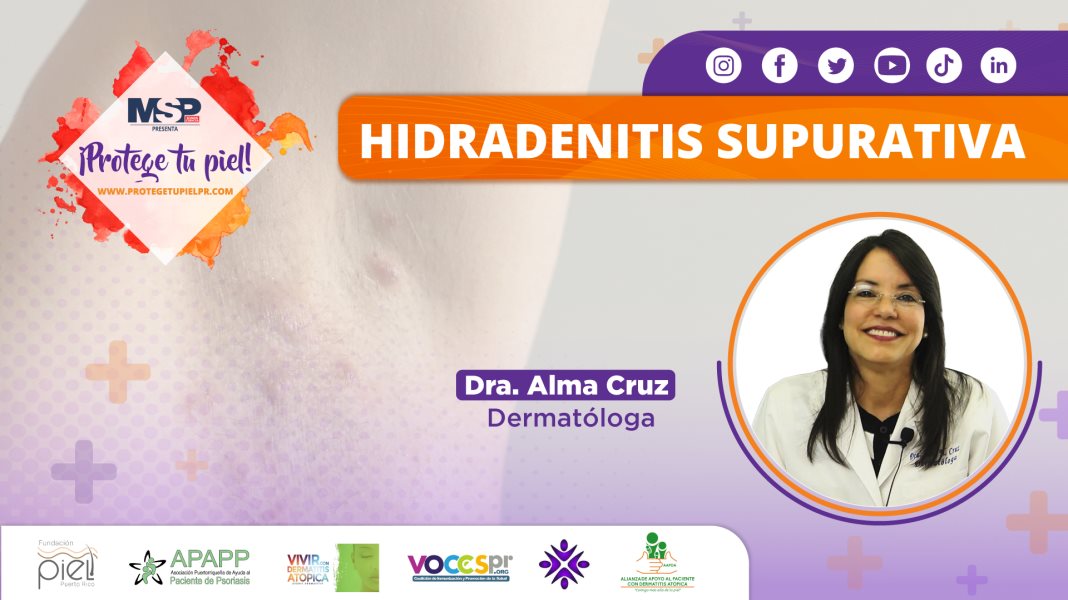 #ProtegeTuPiel | Hidradenitis Supurativa, manejo de heridas y testimoniales