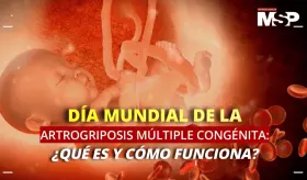 Día Mundial de la Artrogriposis Múltiple Congénita: ¿Qué es y cómo funciona?