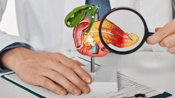 Los alimentos que debe evitar para proteger el páncreas, un órgano esencial Los alimentos que debe evitar para proteger el páncreas, un órgano esencial