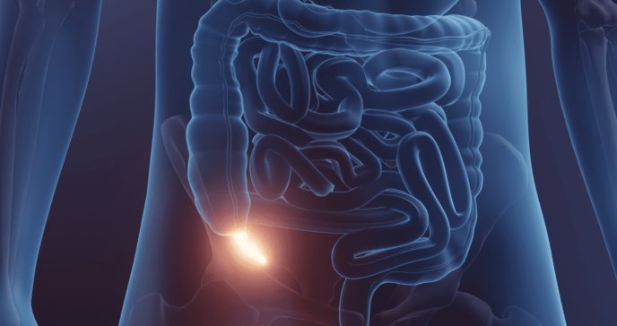 ¿Qué sucedería en el cuerpo humano si no tuviera el apéndice?