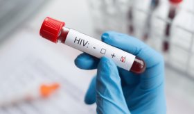 Espermina y espermidina: Los compuestos del semen que limitan la propagación del VIH-1, según estudio